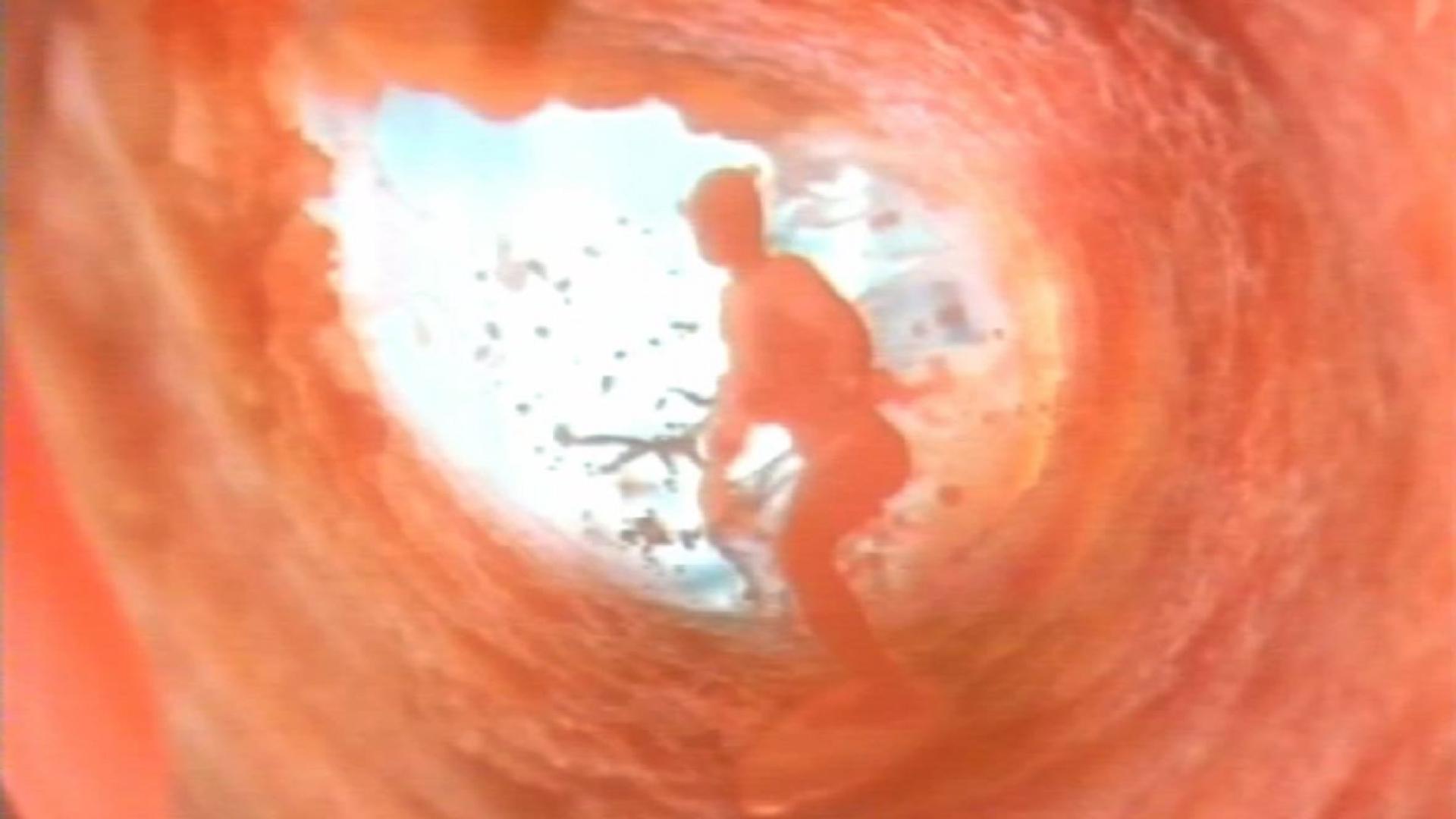 2003